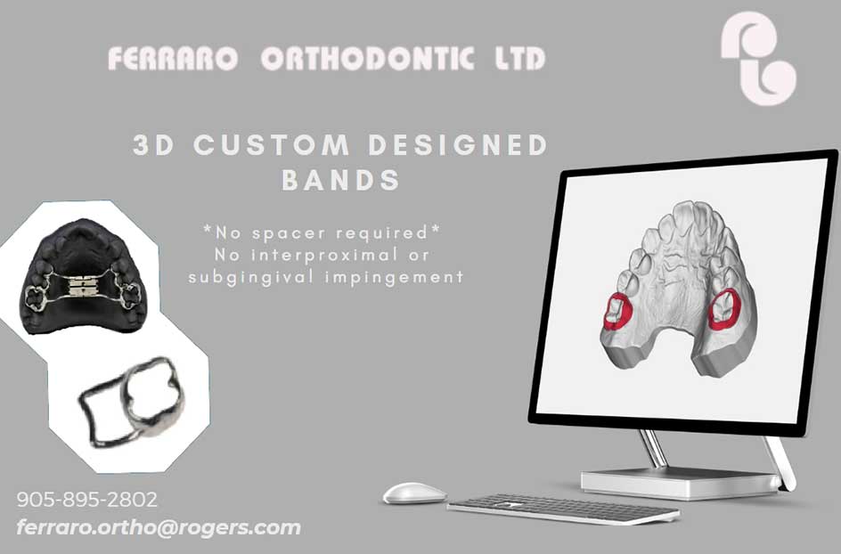 #D custom designed bands